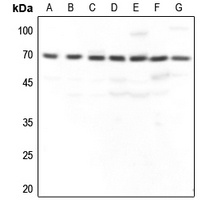 GBP3 Rabbit Polyclonal Antibody