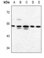Anti-Glucagon Receptor Antibody