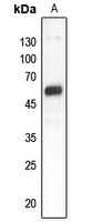 Anti-GDI1 Antibody