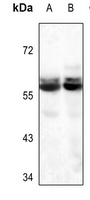 Anti-Glycerol Kinase 1 Antibody