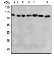 GCLC antibody