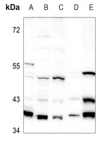 Anti-GNAI1 Antibody
