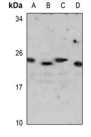 GP1BB antibody