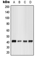 Anti-GPR17 Antibody