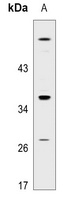 Anti-GPR18 Antibody
