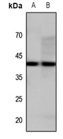 Anti-GPR34 Antibody