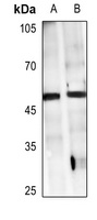 Anti-GPR38 Antibody
