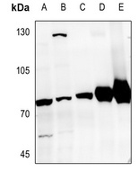 GRK6 antibody