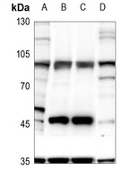 GRIA4 (phospho-S862) antibody