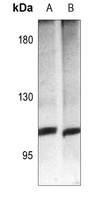 Anti-mGLUR4 Antibody