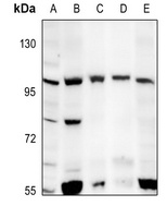 GRM6 antibody