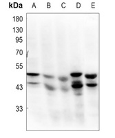 Anti-GSK3 alpha/beta Antibody