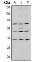 GSK3B (phospho-S9) antibody
