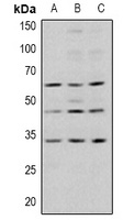 Anti-GSK3 beta (Phospho-S9) Antibody