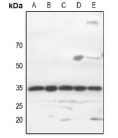 Anti-GTF2E2 Antibody