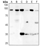 Anti-BRF1 Antibody