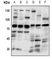 Anti-GUCY1A3 Antibody