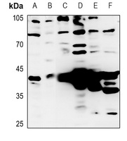 Anti-Granzyme B/H Antibody