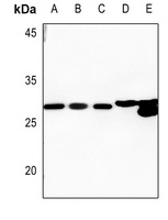 HSD17B10 antibody