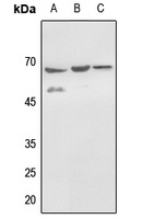 Anti-Histone Deacetylase 1 (Phospho-S421) Antibody