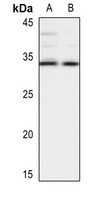 HLA-DOB antibody