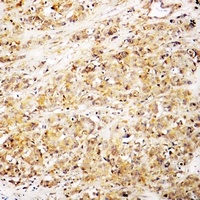 CD168 Rabbit Polyclonal Antibody
