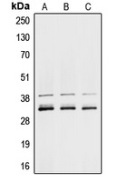 Anti-hnRNP A1 Antibody