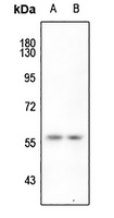 HNRNPK (phospho-S284) antibody