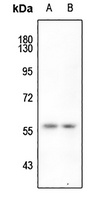 Anti-hnRNP K (Phospho-S284) Antibody