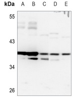 HOXB2 antibody