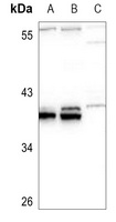 HOXB5 antibody