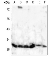 Anti-HOXD8 Antibody