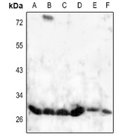 HOXD8 antibody