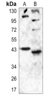 Anti-Histamine H2 Receptor Antibody