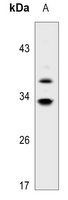 Anti-HSD11B1 Antibody