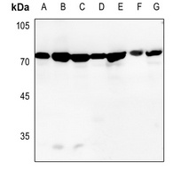 Anti-GRP75 Antibody