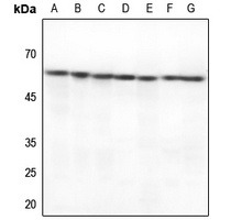 HSPD1 antibody