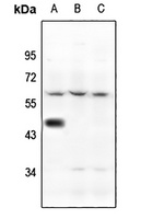 Anti-5-HT1A Antibody