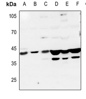 Anti-5-HT1D Antibody