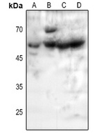 5-HT2B Receptor antibody