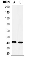 Anti-5-HT4 Antibody