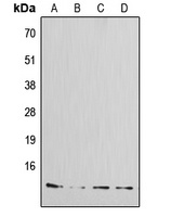 Anti-Amylin Antibody