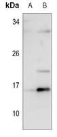 Anti-ID1 Antibody