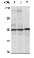 Anti-IGF1 Receptor (Phospho-Y1165/Y1166) Antibody