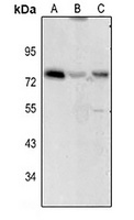 IL2RB antibody