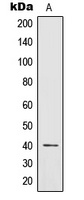 IL12 p40 antibody