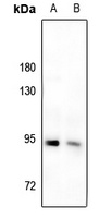 IRAK1 (phospho-T209) antibody