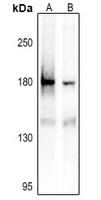 IRS1 (phospho-S1101) antibody