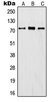 Anti-ITIH1 Antibody
