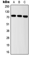 Anti-ITIH2 Antibody